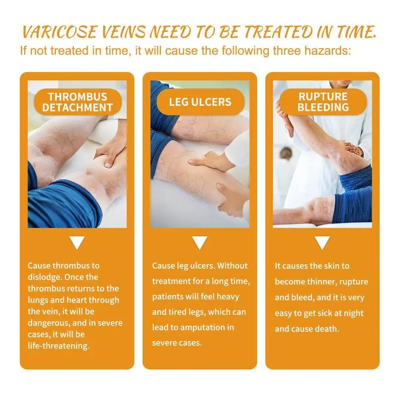 Leg Relief Varicose Veins Cream 50g for Pain and Swelling Body Care Lotions Comfort Skin Care