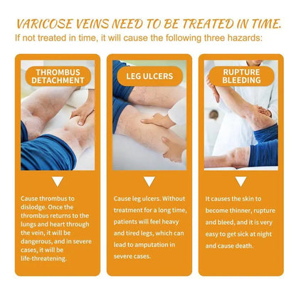 Leg Relief Varicose Veins Cream 50g for Pain and Swelling Body Care Lotions Comfort Skin Care