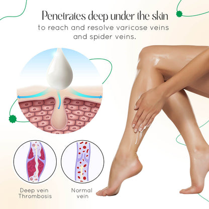 Leg Relief Varicose Veins Cream 50g for Pain and Swelling Body Care Lotions Comfort Skin Care